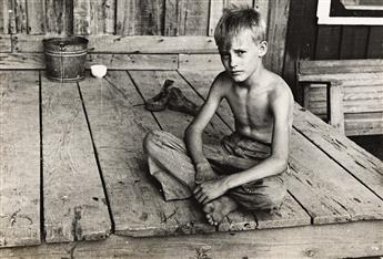 ARTHUR ROTHSTEIN (1915-1985) Son of a Sharecropper, Mississippi County, Arkansas * Sharecroppers child suffering from rickets and maln